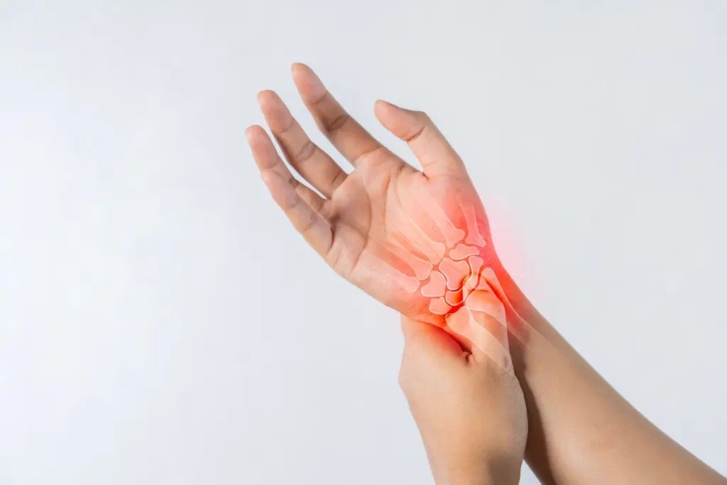 Is Your Carpal Tunnel Pain Getting Worse? Here’s How to Manage It