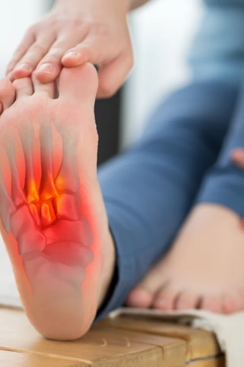 Plantar Fasciitis therapy for severe heel pain relief